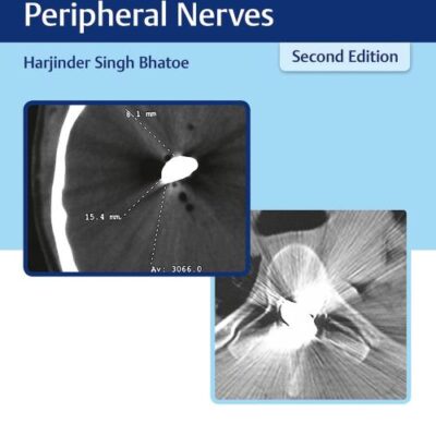 Missile Injuries of the Brain, Spine and Peripheral Nerves