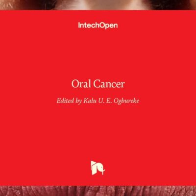 Oral Cancer