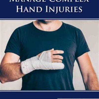 GUIDE TO MANAGE COMPLEX HAND INJURIES