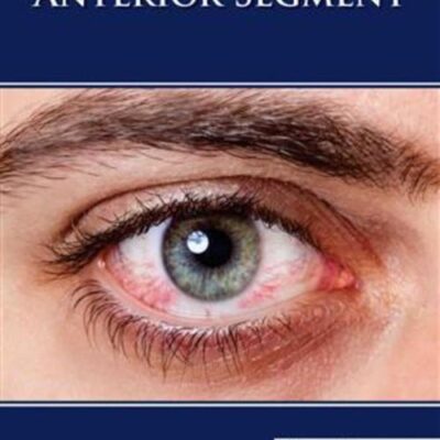 THE DISEASES OF ANTERIOR SEGMENT