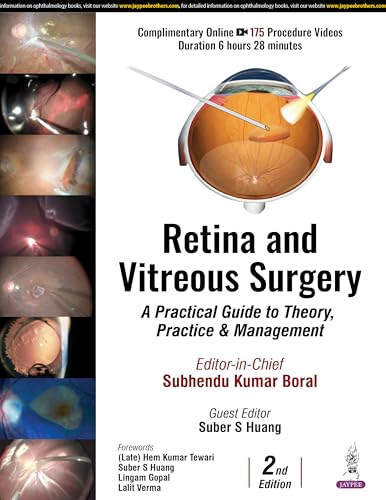 RETINA AND VITREOUS SURGERY : A PRACTICAL GUIDE TO THEORY, PRACTICE & MANAGEMENT