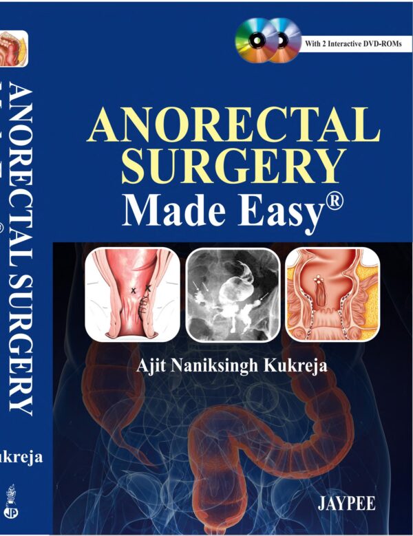Anorectal Surgery - Buy Online India