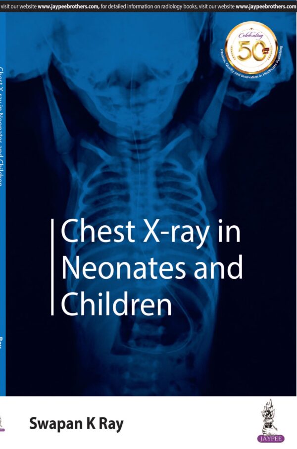 Chest X-Ray in Neonates and Children - Buy Online India