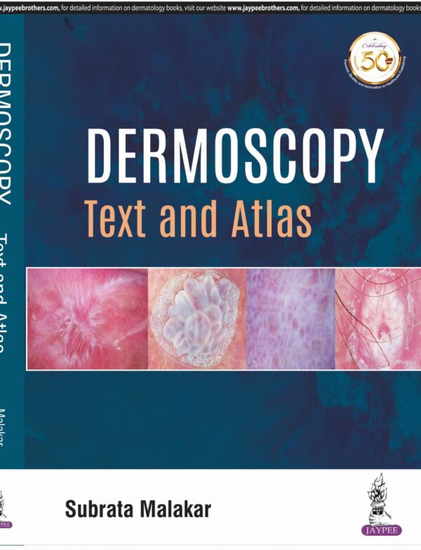 Dermoscopy - Buy Online India