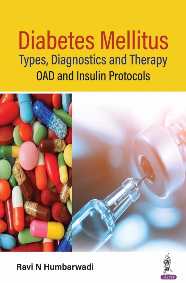 Diabetes Mellitus Types Diagnostics Th : Diabetes Mellitus - Buy Online India