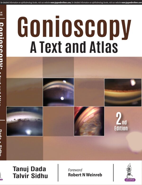Gonioscopy - Buy Online India