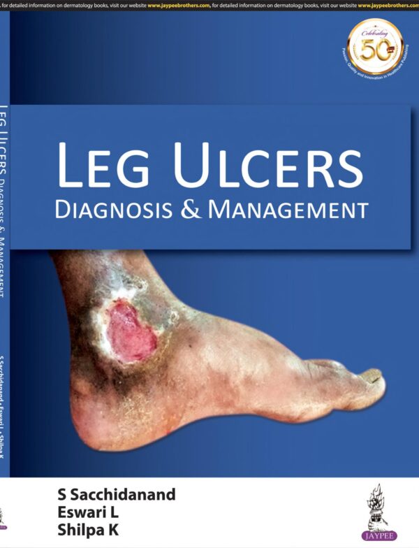 Leg Ulcers - Buy Online India