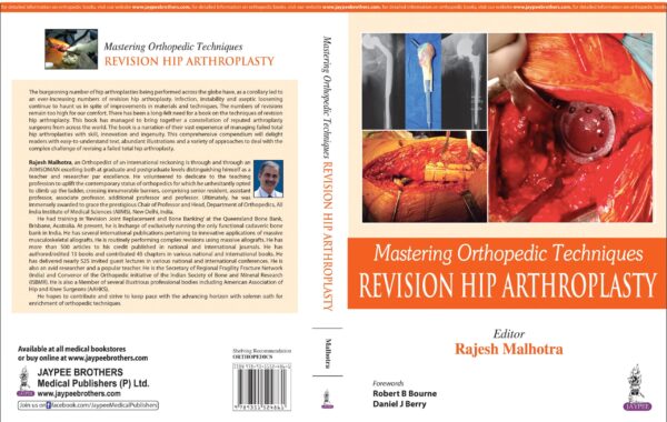 Mastering Orthopedic Techniques - Buy Online India