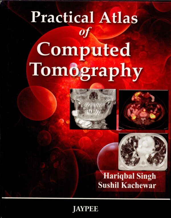 Practical Atlas Of Computed Tomography - Buy Online India