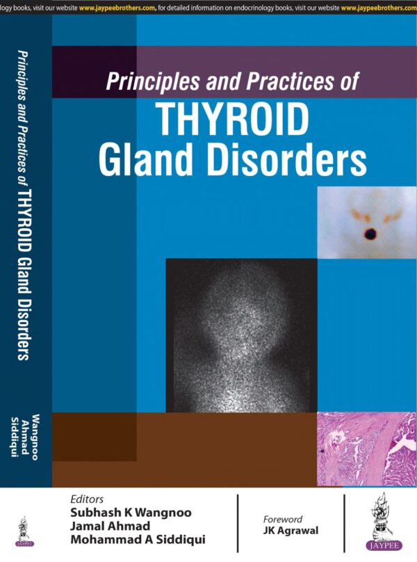 Principles and Practices of Thyroid - Buy Online India
