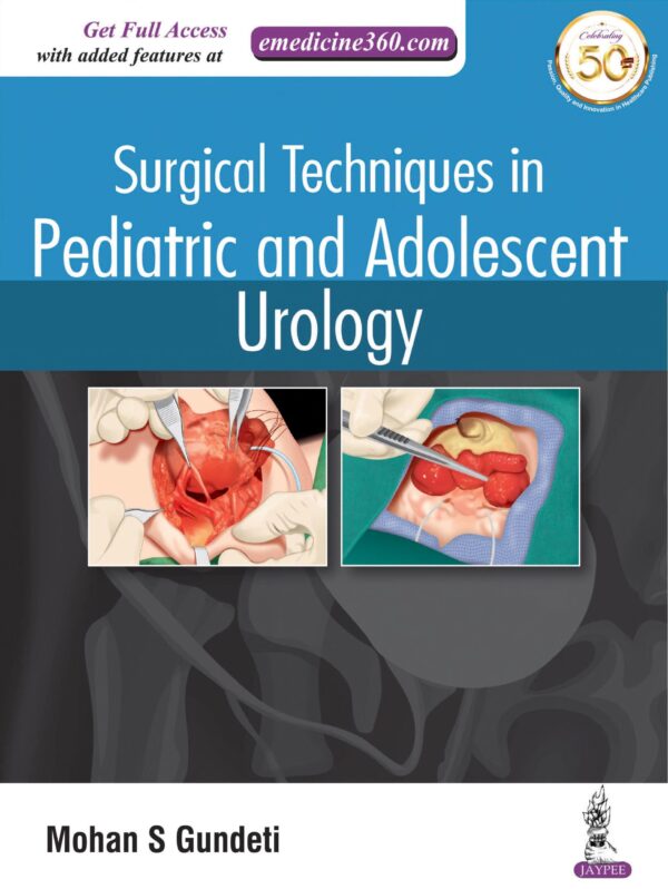 Surgical Techniques in Pediatric and Adolescent Urology - Buy Online India