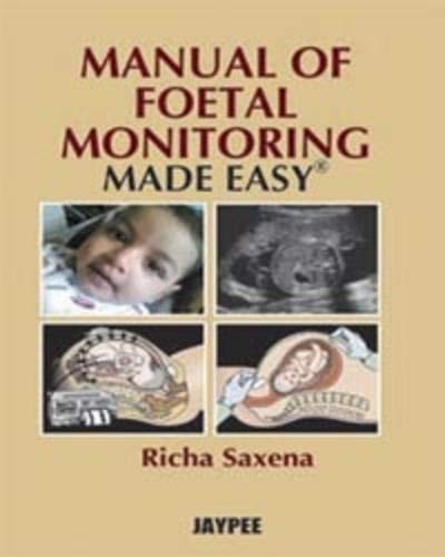 MANUAL OF FOETAL MONITORING MADE EASY