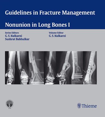 Guidelines in Fracture Management - Nonunion in Long Bones I