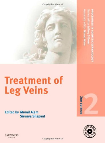 PCDS: Treat of Leg Veins 2/e