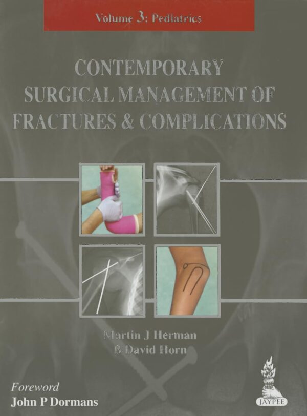 Contemporary Surgical Management of Fractures and Complications: Volume 3: Pediatrics