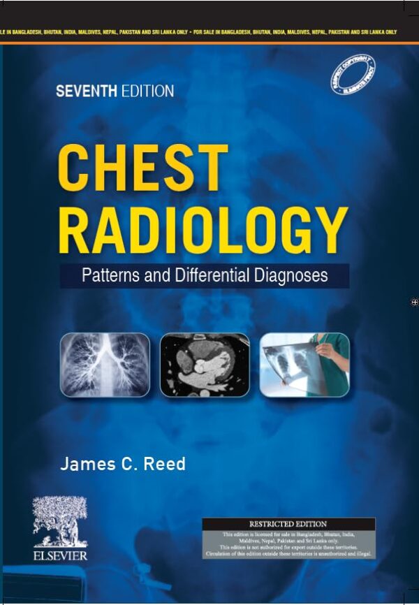 Chest Radiology: Patterns and Differential Diagnoses (SAE) -7E