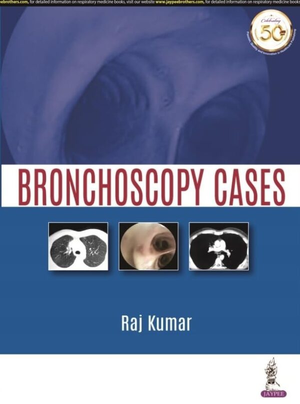 Bronchoscopy Cases (POD)