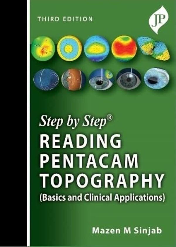 STEP BY STEP READING PENTACAM TOPOGRAPHY (BASICS AND CLINICAL APPLICATIONS)