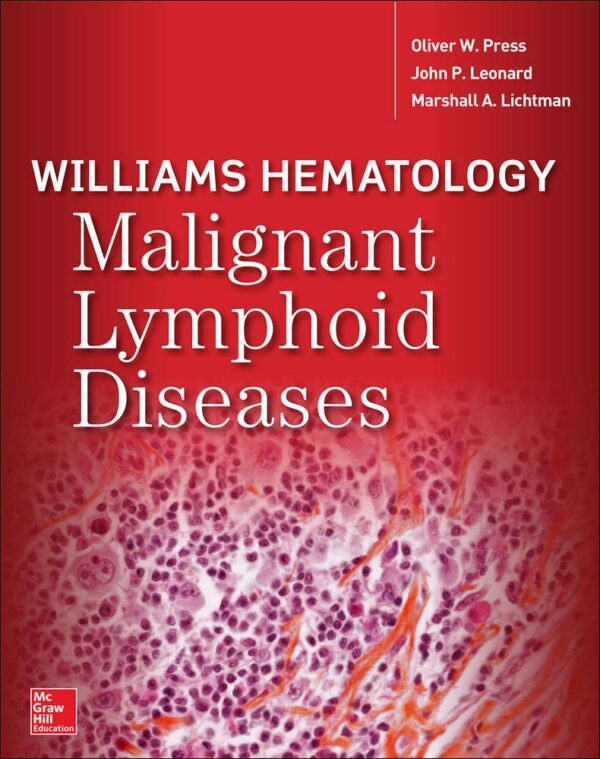 Williams Hematology Malignant Lymphoid Diseases