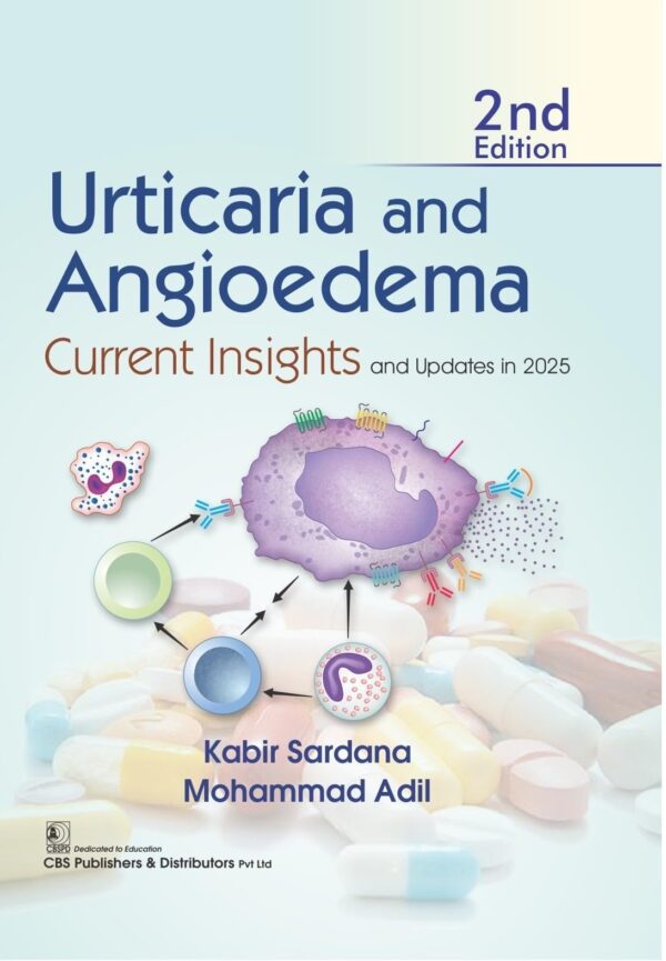 URTICARIA AND ANGIOEDEMA CURRENT INSIGHTS AND UPDATES IN 2025 2ED (HB 2026)