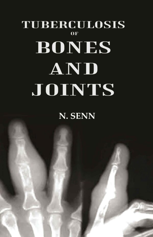 Tuberculosis of Bones and Joints
