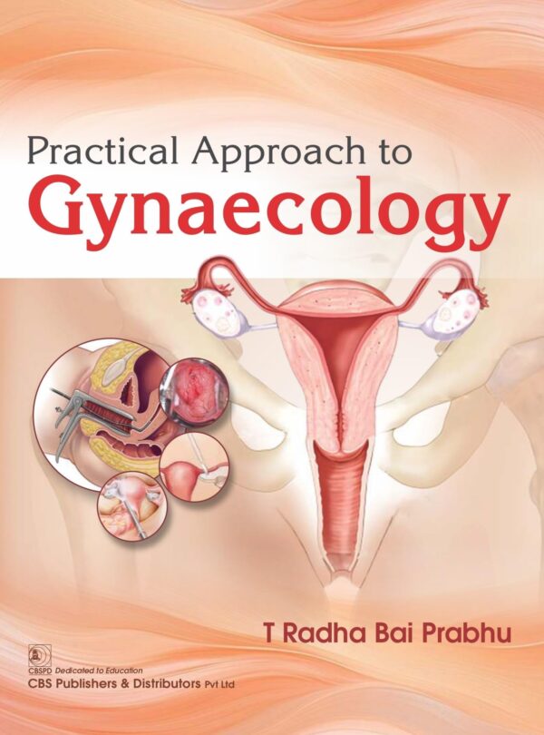 Practical Approach to Gynaecology - (PB 2026)