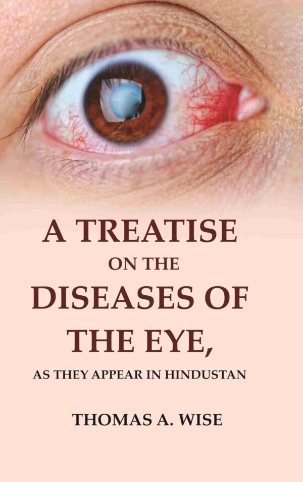 A Treatise on the Diseases of The Eye: As they Appear in Hindustan [Hardcover]