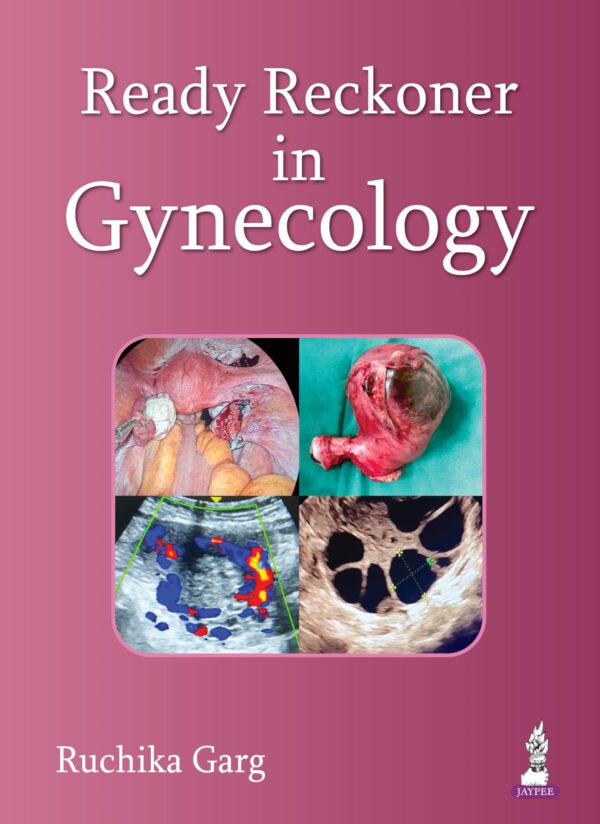 Ready Reckoner in Gynecology