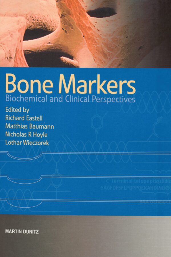 Bone Markers: Biochemical and Clinical Perspectives