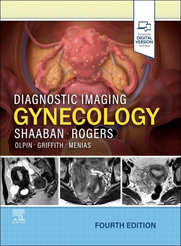 Diagnostic Imaging Gynecology