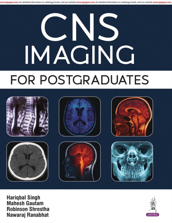 CNS IMAGING FOR POSTGRADUATES