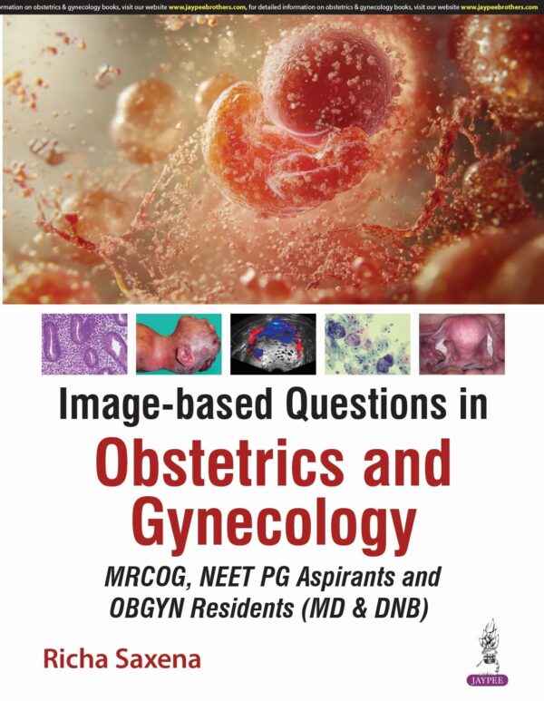 Image-based Questions in Obstetrics and Gynecology: An Evidence Based Color Atlas