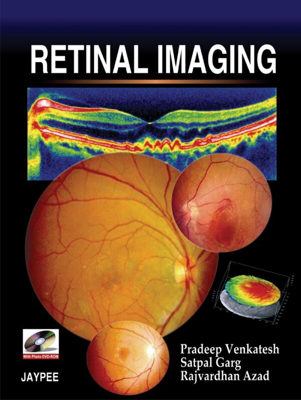 Retinal Imaging with Photo DVD-ROM