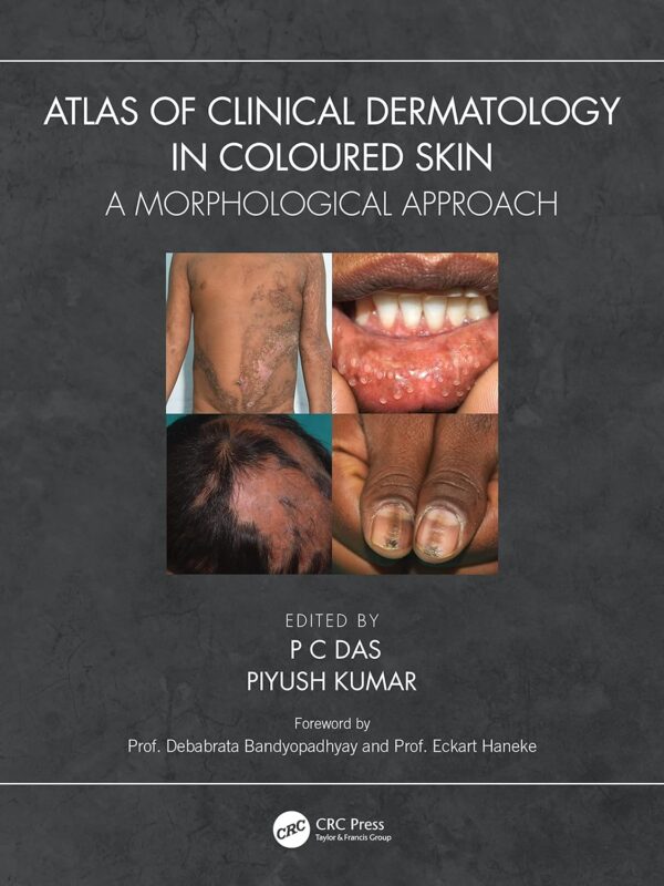 ATLAS OF CLINICAL DERMATOLOGY IN COLOURED SKIN A MORPHOLOGICAL APPROACH (PB 2024)