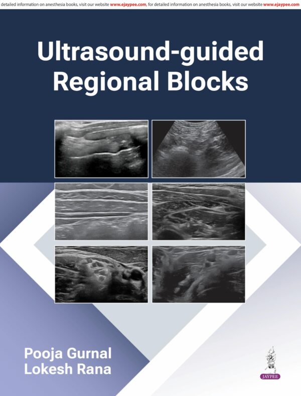 Ultrasound-Guided Regional Blocks