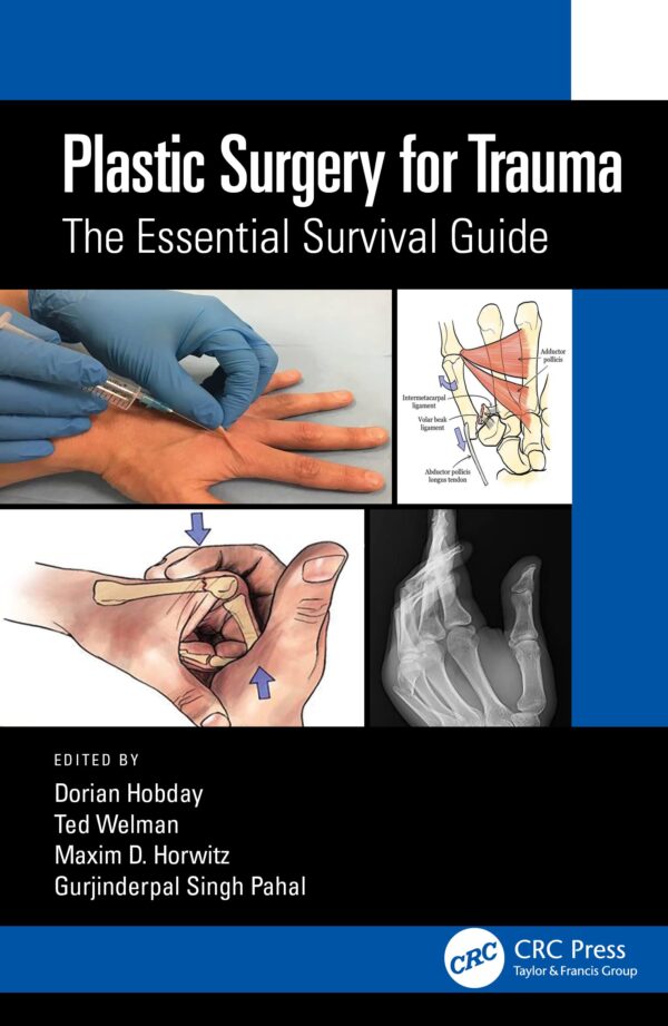 Plastic Surgery For Trauma The Essential Survival Guide (Pb 2022)