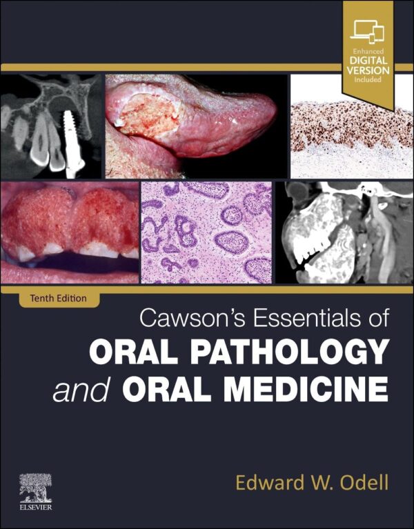 CAWSONS ESSENTIALS OF ORAL PATHOLOGY AND ORAL MEDICINE WITH ACCESS CODE 10ED (PB 2025)