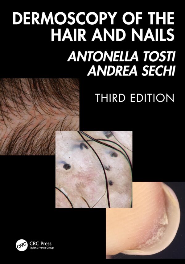 DERMOSCOPY OF THE HAIR AND NAILS 3ED (HB 2025)