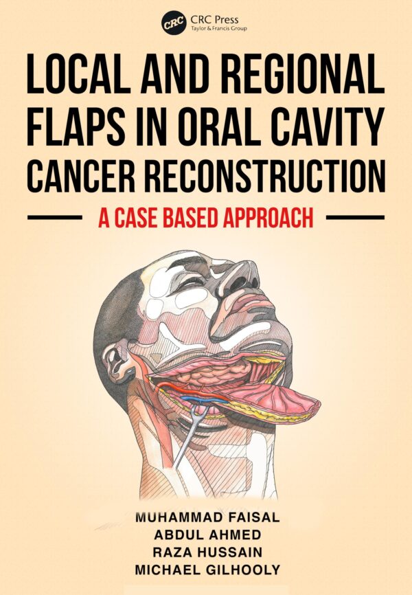 LOCAL AND REGIONAL FLAPS IN ORAL CAVITY CANCER RECONSTRUCTION A CASE BASED APPROACH (PB 2026)