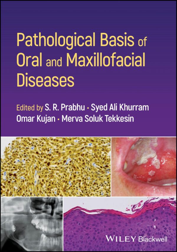 Pathological Basis of Oral and Maxillofacial Diseases