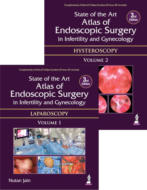 State of the Art Atlas of Endoscopic Surgery in Infertility and Gynecology (2Vols): Two Volume Set