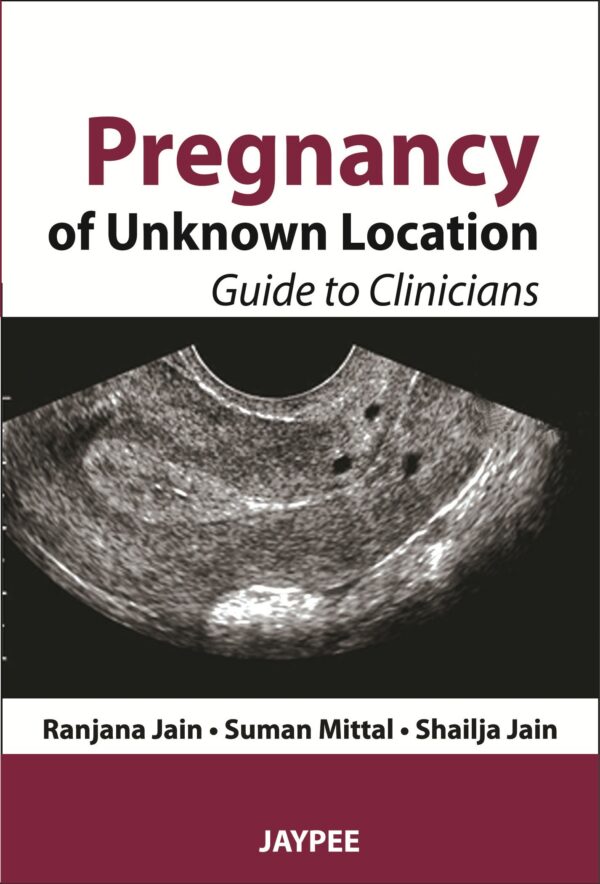 PREGNANCY OF UNKNOWN LOCATION GUIDE TO CLINICIANS