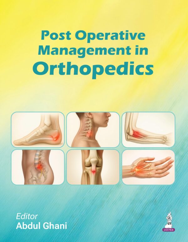 Post Operative Management in Orthopedics