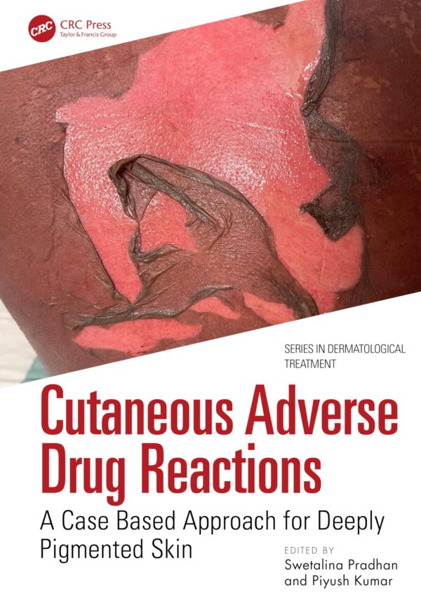 CUTANEOUS ADVERSE DRUG REACTIONS A CASE BASED APPROACH FOR DEEPLY PIGMENTED SKIN (PB 2026) (Series in Dermatological Treatment)