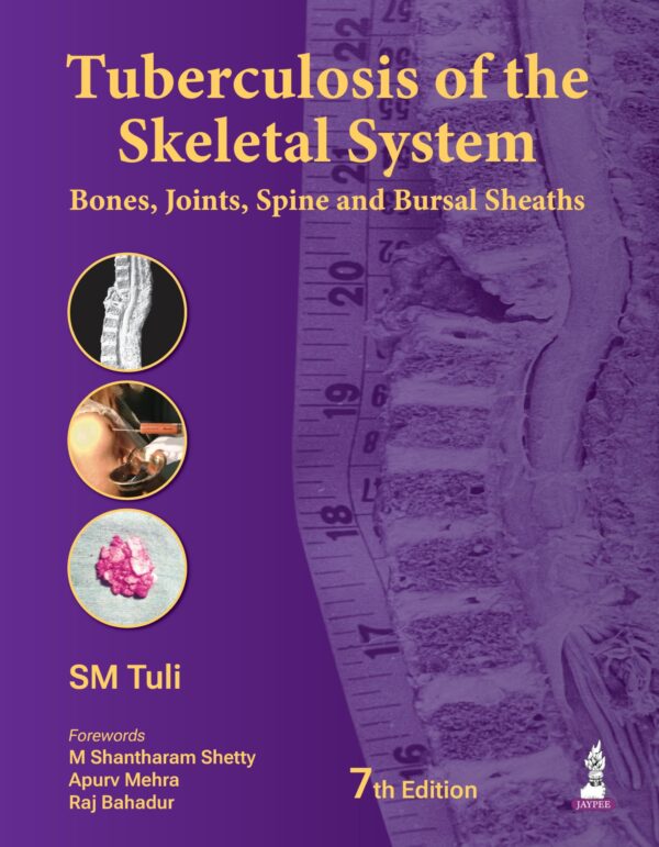 Tuberculosis of the Skeletal System (Bones, Joints, Spine and Bursal Sheaths)