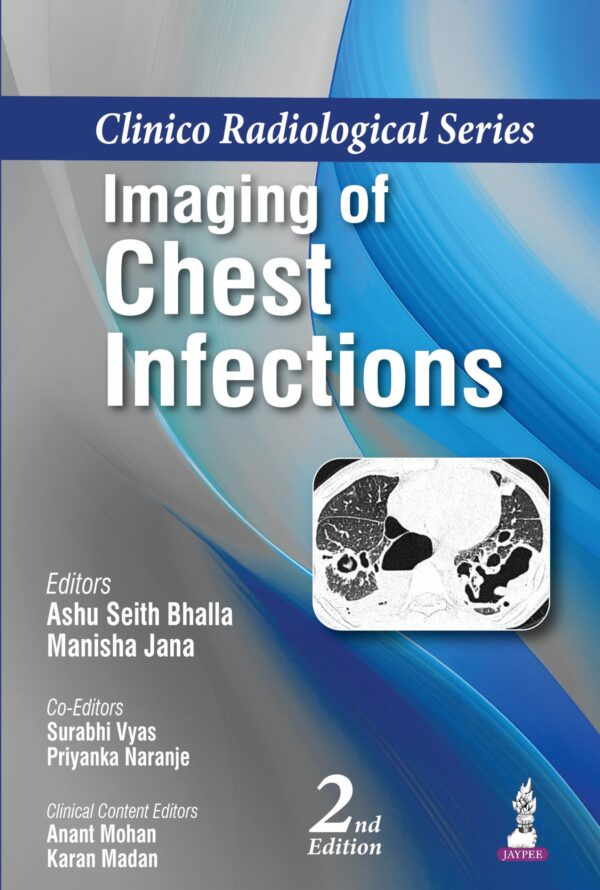 Clinico Radiological Series Imaging of Chest Infections