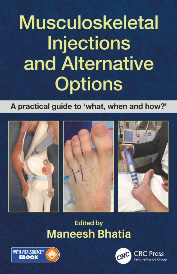 Musculoskeletal Injections And Alternative Options A Practical Guide To What When And How (Pb 2019)