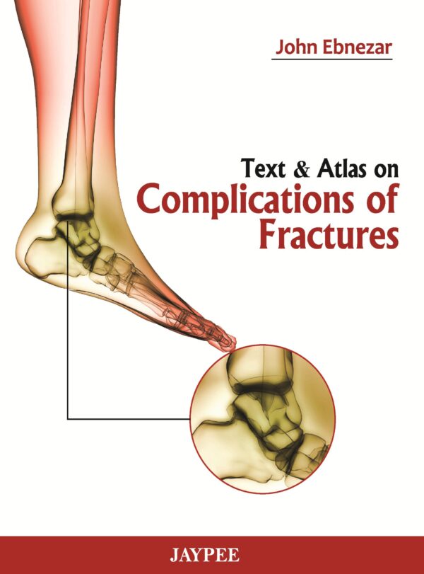 TEXT & ATLAS ON COMPLICATIONS OF FRACTURES