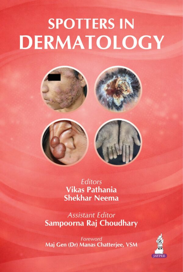 Spotters in Dermatology
