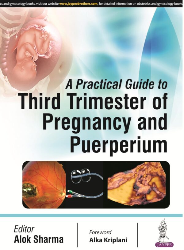 A PRACTICAL GUIDE TO THIRD TRIMESTER OF PREGNANCY AND PUERPERIUM